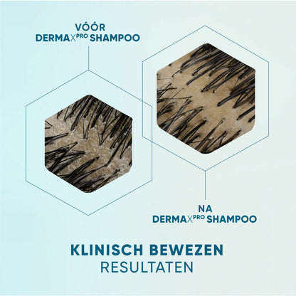 Head & Shoulders Anti-roos Shampoo DERMAxPRO Hydrateert 250 ml