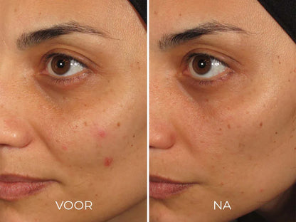 Image Skincare ILUMA - Intense Facial Illuminator 30 ml - K Drogerie