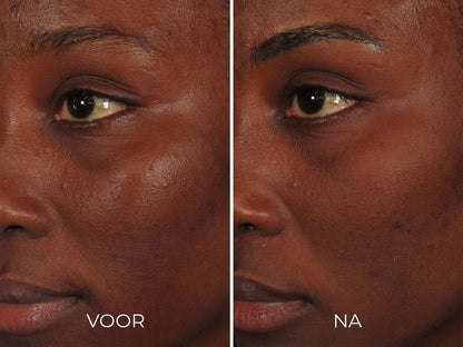 Image Skincare ILUMA - Intense Facial Illuminator 30 ml - K Drogerie